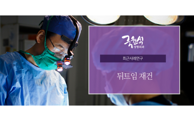 뒤트임재건 최근 사례연구를 통해 확인하기!