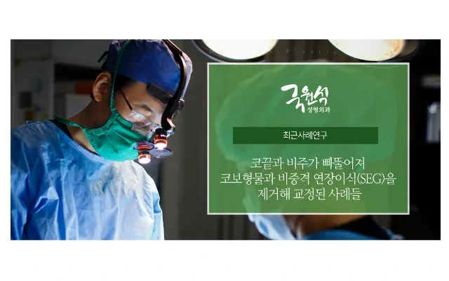 코끝과 비주가 삐둘어져 코보형물과 비중격 연장이식(SEG)을 제거해 교정된 사례들