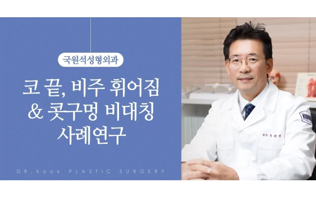 코끝, 비주 휘어짐 ＆ 콧구멍 비대칭 사례연구 (제거 + 비개방 단순재배치) 1