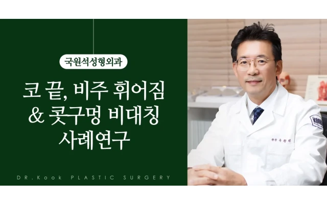 코끝, 비주 휘어짐 ＆ 콧구멍 비대칭 사례연구 (제거 + 비개방 단순재배치) 2
