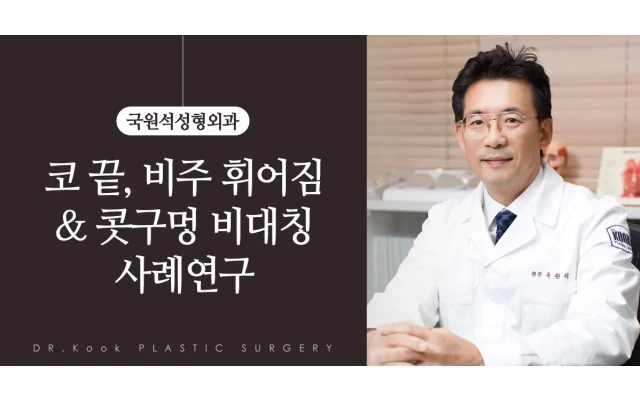 코끝, 비주 휘어짐 ＆ 콧구멍 비대칭 사례연구 (제거 + 개방형 복합재배치) 3