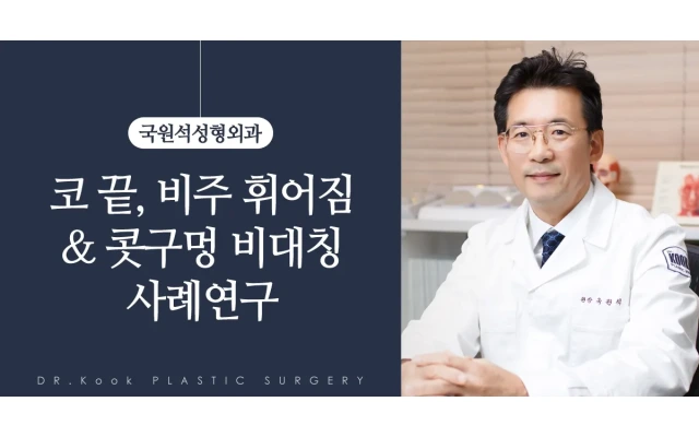 코끝, 비주 휘어짐 ＆ 콧구멍 비대칭 사례연구 (제거 + 개방형 복합재배치) 4