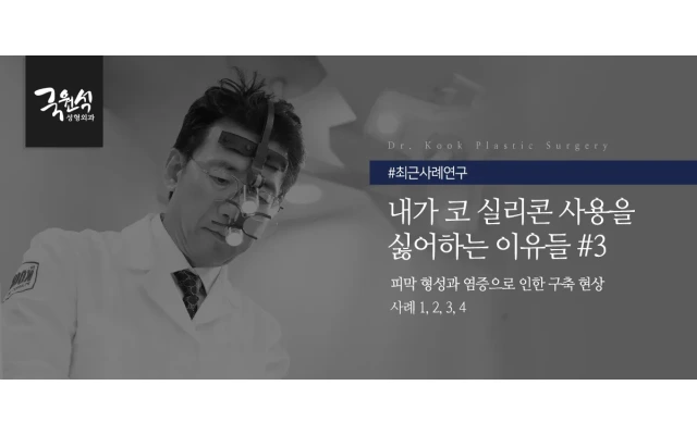 내가 코실리콘 보형물 사용을 싫어하는 이유 #3 (코보형물제거, 코실리콘제거, 구축코수술)