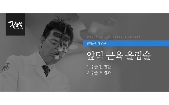 앞턱근육올림술 연구사례 (자갈주름/입벌어짐/앞턱근육재배치/안면윤곽부작용)
