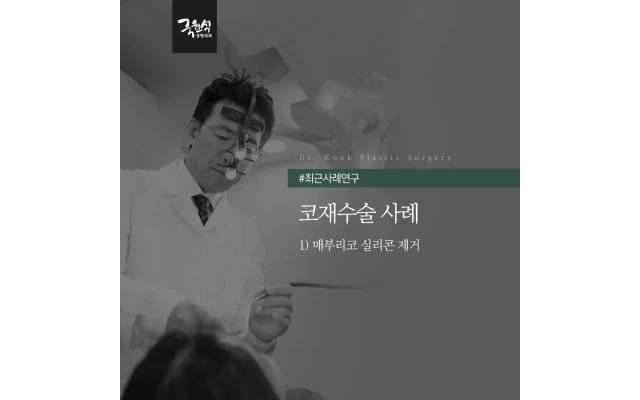 매부리코 실리콘 제거 재수술로 교정 사례
