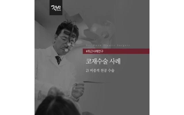 코재수술성형외과, 비중격 천공 + 코 실리콘(보형물) 제거 사례