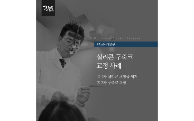 실리콘 구축코 교정 사례 (코 실리콘 보형물 제거 & 구축코 교정 2차 수술)