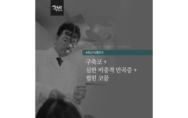 구축코, 심한 비중격 만곡증, 찝힌 코끝 늑연골 재수술 사례
