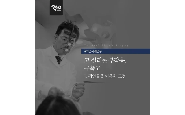 코 실리콘 부작용, 구축코 "귀연골"로 교정한 실제 사례 