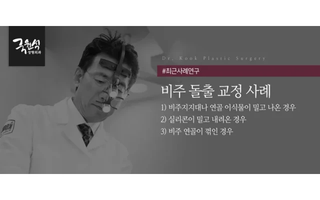 코 성형 부작용 '비주 돌출' 교정 사례