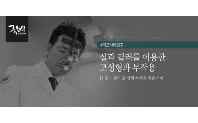 실과 필러를 이용한 코성형과 부작용 해결 사례