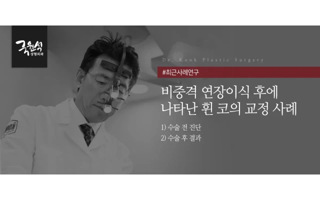 비중격 연장이식 후에 나타난 휜 코의 교정 사례 #휜코 #코성형 #코재수술